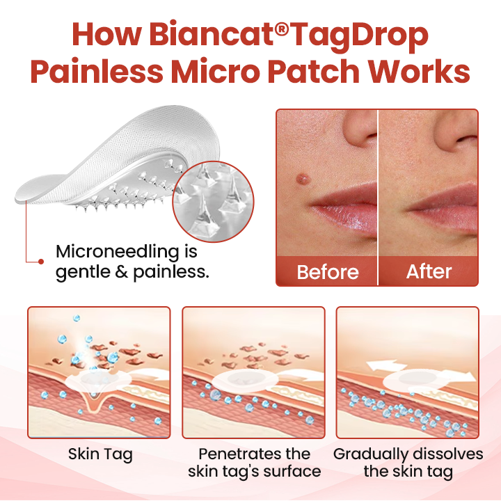 Biancat® TagDrop Painless Micro Patch