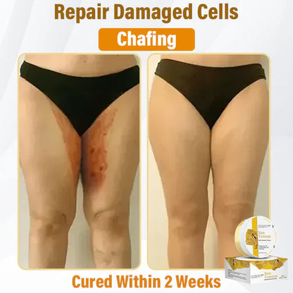 Ceoerty™ Bee Venom Skin Renewal Cream (UK)