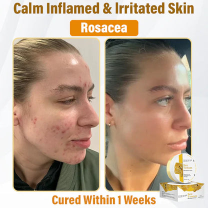 Ceoerty™ Bee Venom Skin Renewal Cream (UK)