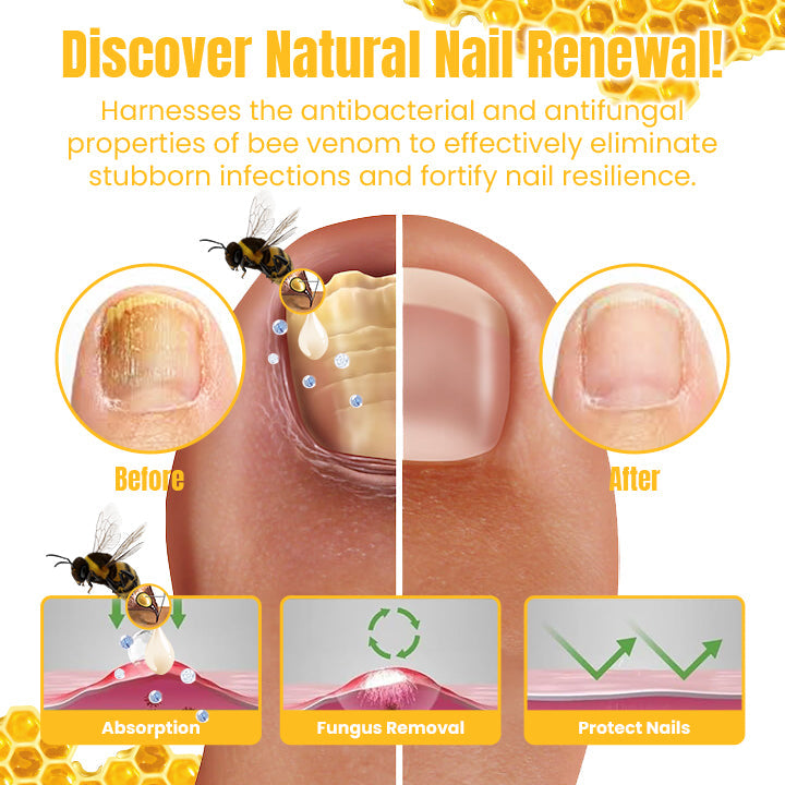 Ceoerty™ FungiGone Bee Venom Nail Cream (US)