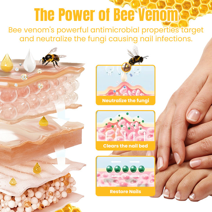 Ceoerty™ FungiGone Bee Venom Nail Cream (US)