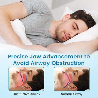 Ceoerty™ Anti-Snoring & Anti-Grinding Teeth Protector