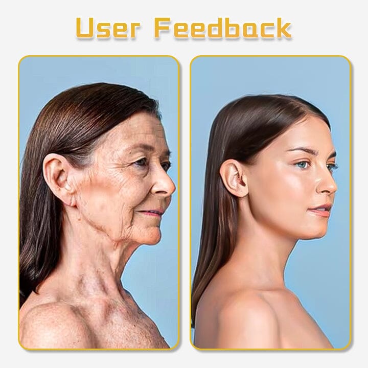 Biancat™ UltraRenew Supersonic Facelift Device.