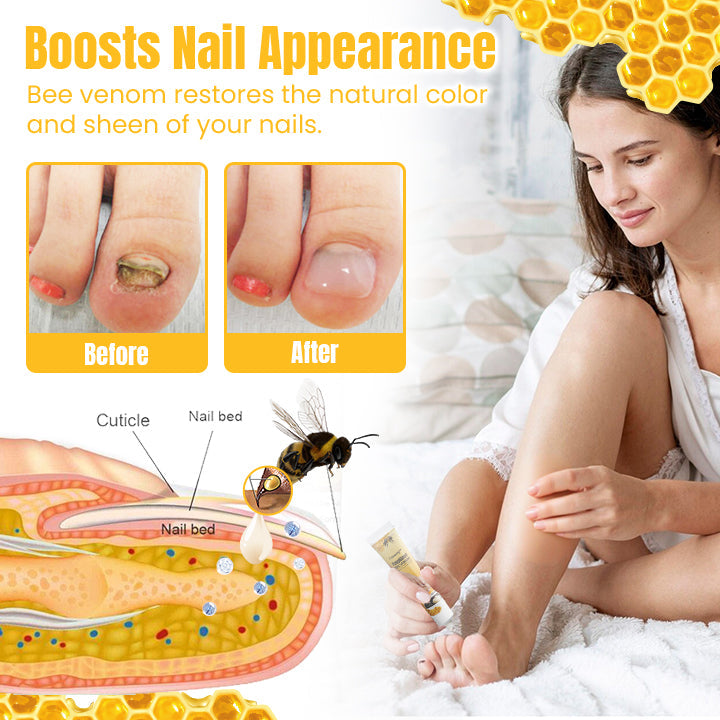 Ceoerty™ FungiGone Bee Venom Nail Cream (US)