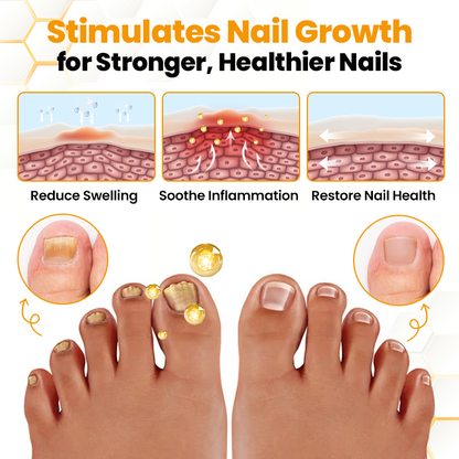 Biancat™ BeeVenom Anti-Fungal Nail Renewal Oil