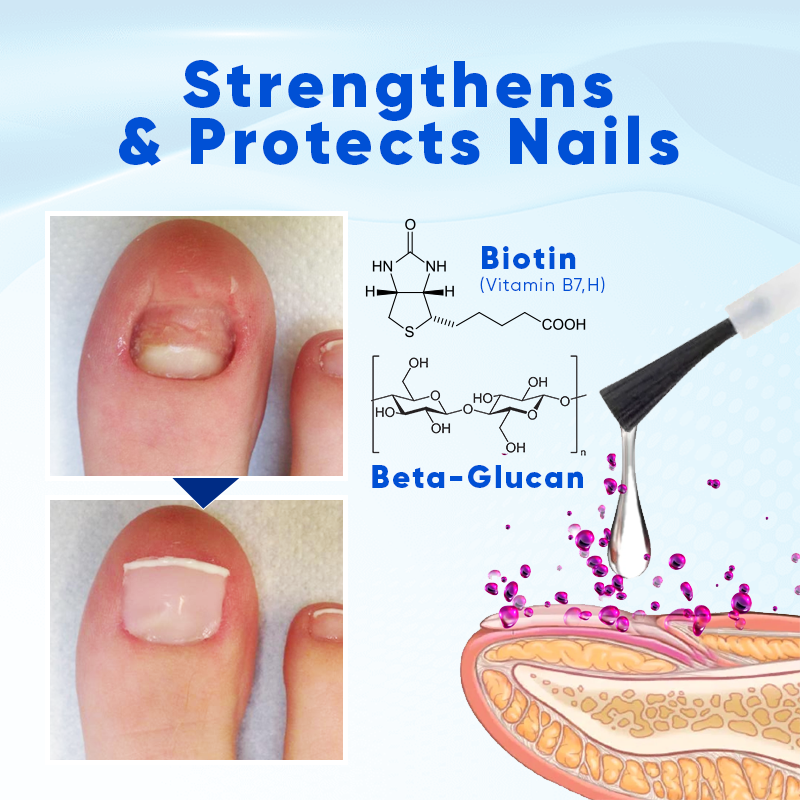 Biancat™ NailNourish  Growth & Repair Serum